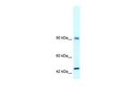 RBM10 Antibody in Western Blot (WB)