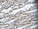 RBM10 Polyclonal Antibody
