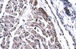 TAF15 Polyclonal Antibody
