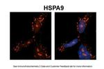 HSPA9 Antibody in Immunohistochemistry (IHC)