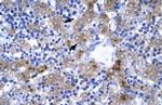 IRF9 Polyclonal Antibody