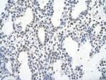 Fra1 Polyclonal Antibody