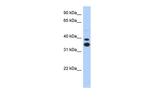 MSX2 Antibody in Western Blot (WB)