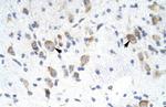 GTF2F2 Antibody in Immunohistochemistry (Paraffin) (IHC (P))