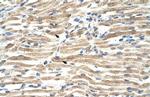 YAF2 Polyclonal Antibody