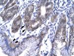 EAP30 Polyclonal Antibody