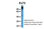 ELF2 Antibody in Western Blot (WB)
