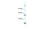 FGD1 Antibody in Western Blot (WB)