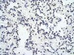 ZNF652 Polyclonal Antibody