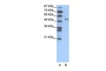 FOXD2 Polyclonal Antibody