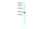 SSBP2 Antibody in Western Blot (WB)