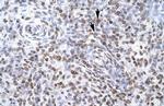 ZNF500 Antibody in Immunohistochemistry (IHC)
