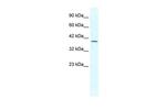 GBX2 Polyclonal Antibody