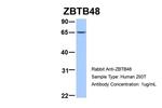 ZBTB48 Antibody in Western Blot (WB)