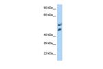 HOXA13 Polyclonal Antibody