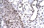 BARHL2 Polyclonal Antibody