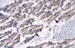 ZNF391 Polyclonal Antibody
