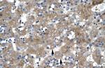 ZNF81 Polyclonal Antibody