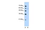 IRX4 Polyclonal Antibody