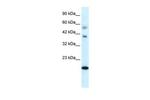 CGI-143 Antibody in Western Blot (WB)