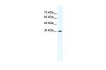 DVL1 Polyclonal Antibody