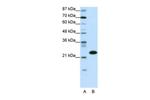 TAF11 Polyclonal Antibody