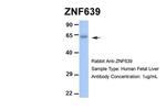 ZNF639 Antibody in Western Blot (WB)