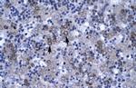 DBP Polyclonal Antibody