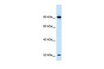 SOX30 Polyclonal Antibody