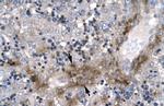 ZNF365 Polyclonal Antibody