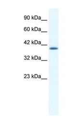 ZNF365 Antibody in Western Blot (WB)