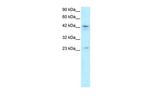 ZNF365 Antibody in Western Blot (WB)