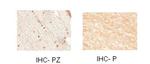 Nkx2.2 Antibody in Immunohistochemistry (IHC)