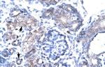 TBX19 Polyclonal Antibody