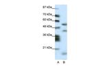 LIM1 Polyclonal Antibody