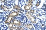 SIX6 Polyclonal Antibody