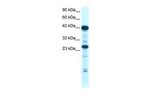 SIX6 Antibody in Western Blot (WB)