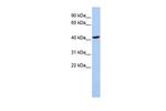 LHX4 Polyclonal Antibody