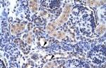 TAF1 Polyclonal Antibody