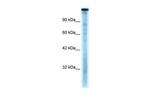 TAF1 Antibody in Western Blot (WB)