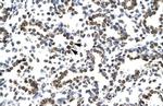 ZNF385A Polyclonal Antibody