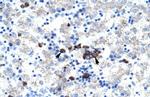 ABT1 Antibody in Immunohistochemistry (IHC)