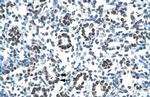 HOXB9 Antibody in Immunohistochemistry (Paraffin) (IHC (P))
