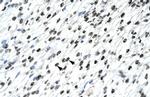 HOXB9 Antibody in Immunohistochemistry (Paraffin) (IHC (P))