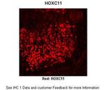HOXC11 Polyclonal Antibody