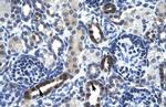 TSFM Polyclonal Antibody