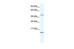 TSFM Antibody in Western Blot (WB)
