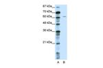 NOTCH4 Antibody in Western Blot (WB)