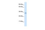 CGI-62 Antibody in Western Blot (WB)