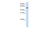 TADA3L Polyclonal Antibody